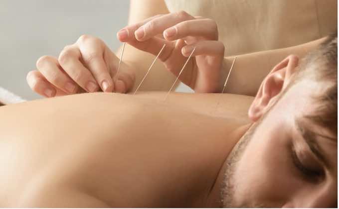 5 Reasons Why Chiropractic and Acupuncture Should Be Used Together
